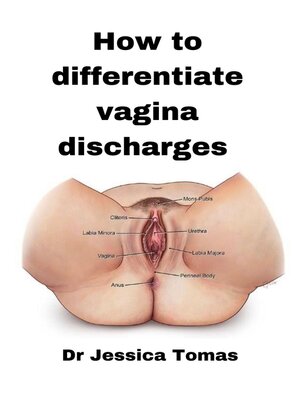 cover image of Howw to Differentiate Vagina Discharges